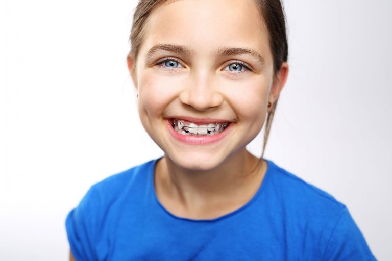 types-of-bite-problems-that-require-orthodontic-treatment