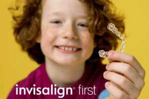 Invisalign First